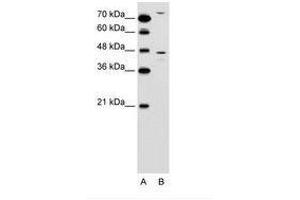 Image no. 1 for anti-Chemokine Binding Protein 2 (CCBP2) (N-Term) antibody (ABIN6736593) (CCBP2 antibody  (N-Term))