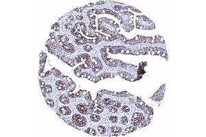 Moderate to strong Hepatocyte immunostaining in epithelial cells of the duodenum (Hepatocyte Specific Antigen antibody)