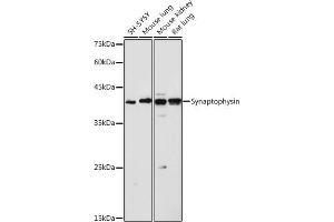 Western blot analysis of extracts of various cell lines, using Synaptophysin antibody (ABIN6135349, ABIN6148783, ABIN6148784 and ABIN6221958) at 1:1000 dilution. (Synaptophysin antibody  (AA 150-250))