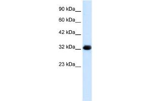 WB Suggested Anti-HS747E2A Antibody Titration:  1. (C22orf31 antibody  (Middle Region))