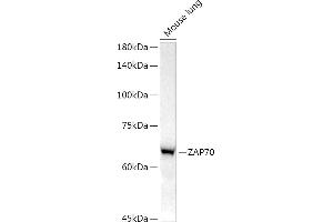Western blot analysis of extracts of Mouse lung, using Z antibody (ABIN7271430) at 1:1000 dilution. (ZAP70 antibody)
