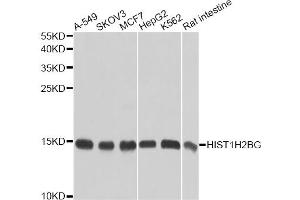 Western blot analysis of extracts of various cell lines, using HIST1H2BG antibody. (HIST1H2BG antibody)