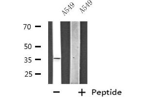 Western blot analysis of extracts from HeLa cells, using ZNF691 antibody. (ZNF691 antibody  (Internal Region))