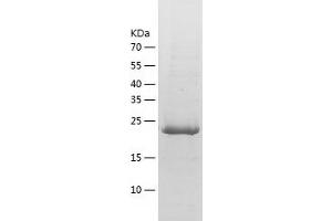 Western Blotting (WB) image for Latexin (LXN) (AA 2-222) protein (His tag) (ABIN7288584) (Latexin Protein (LXN) (AA 2-222) (His tag))