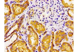 Immunohistochemistry of paraffin-embedded human kidney tissue using ABIN7153179 at dilution of 1:100 (FZD1 antibody  (AA 125-225))