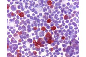Immunohistochemistry (IHC) image for anti-S100 Calcium Binding Protein A8 (S100A8) antibody (ABIN920692) (S100A8 antibody)