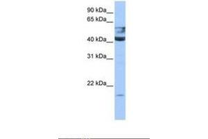 Image no. 1 for anti-Queuine tRNA-Ribosyltransferase 1 (QTRT1) (AA 45-94) antibody (ABIN6738529) (QTRT1 antibody  (AA 45-94))