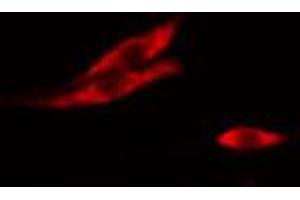 ABIN6267021 staining A-431 cells by IF/ICC. (TRHR antibody)