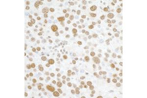 Immunohistochemistry (IHC) image for anti-H2A Histone Family, Member X (H2AFX) (C-Term) antibody (ABIN7449536) (H2AFX antibody  (C-Term))