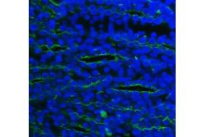 anti-Solute Carrier Family 12 (Sodium/potassium/chloride Transporters), Member 1 (SLC12A1) (AA 52-83), (N-Term) antibody