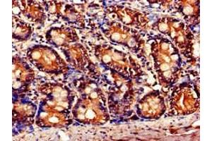 Immunohistochemistry of paraffin-embedded human small intestine tissue using ABIN7145827 at dilution of 1:100