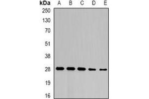 Western blot analysis of NFU1 expression in SW480 (A), mouse liver (B), mouse heart (C), rat liver (D), rat heart (E) whole cell lysates.