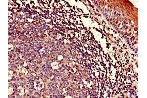 Immunohistochemistry of paraffin-embedded human tonsil tissue using ABIN7143153 at dilution of 1:100 (ASCC1 antibody  (AA 1-315))