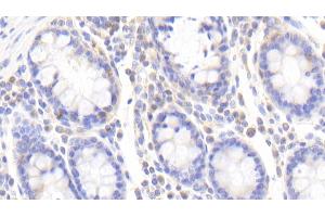 Detection of ZRF1 in Human Colon Tissue using Polyclonal Antibody to Zuotin Related Factor 1 (ZRF1) (DNAJC2 antibody  (AA 442-621))