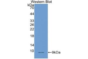 Detection of Recombinant PLAC9, Human using Monoclonal Antibody to Placenta Specific Protein 9 (PLAC9)