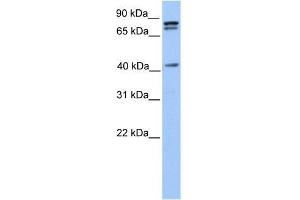 SUZ12 antibody used at 0. (SUZ12 antibody  (C-Term))
