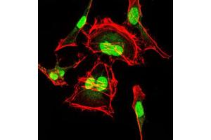 Immunofluorescence analysis of HeLa cells using CDK2 antibody (green). (CDK2 antibody)