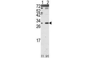 Image no. 2 for anti-Dickkopf 2 Homolog (DKK2) (N-Term) antibody (ABIN357069) (DKK2 antibody  (N-Term))
