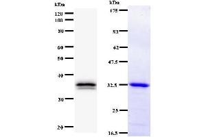 Left: TEAD2 staining. (TEAD2 antibody)