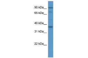 WB Suggested Anti-FGFR2 Antibody Titration: 0. (FGFR2 antibody  (Middle Region))