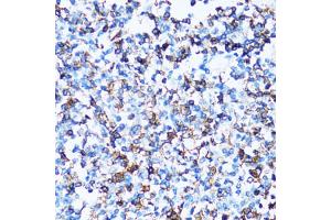 Immunohistochemistry of paraffin-embedded human tonsil using SPN antibody (ABIN5973813) at dilution of 1/100 (40x lens). (CD43 antibody)