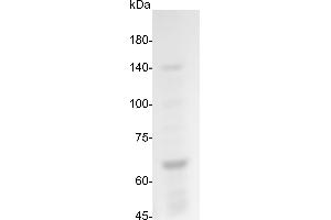 SDS-PAGE (SDS) image for Influenza Virus Nucleoprotein (IV NP) protein (His tag) (ABIN7884410)