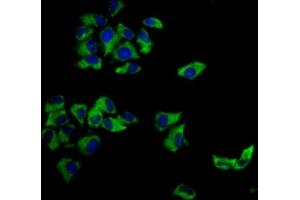 Immunofluorescence staining of Hela cells with ABIN7148294 at 1:166, counter-stained with DAPI. (MCC antibody  (AA 479-611))