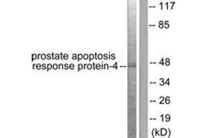Western blot analysis of extracts from NIH-3T3 cells, using Prostate Apoptosis Response protein-4 Antibody. (PAWR antibody  (AA 291-340))