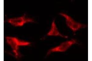 ABIN6278181 staining HepG2 by IF/ICC. (ABAT antibody  (Internal Region))