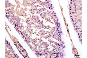 Formalin-fixed and paraffin embedded rat testis labeled with Anti-DDX43/CT13 Polyclonal Antibody, Unconjugated (ABIN716021) at 1:200 followed by conjugation to the secondary antibody and DAB staining. (DDX43 antibody  (AA 481-580))
