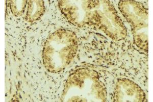 Immunohistochemistry (IHC) image for anti-Estrogen Receptor Binding Site Associated, Antigen, 9 (EBAG9) (C-Term) antibody (ABIN6261417)