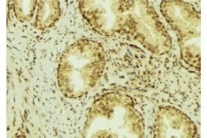 ABIN6276966 at 1/100 staining Mouse colon tissue by IHC-P. (RCAS1 antibody  (C-Term))