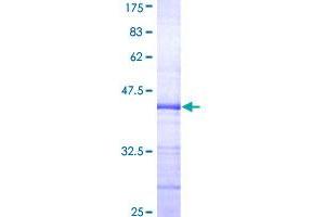 ELF3 Protein (AA 262-371) (GST tag)