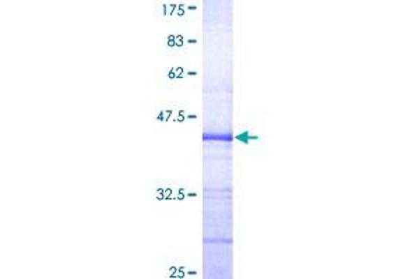 ELF3 Protein (AA 262-371) (GST tag)