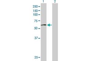 Western Blot analysis of ACCS expression in transfected 293T cell line by ACCS MaxPab polyclonal antibody. (PHACS antibody  (AA 1-501))