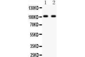 Anti- GRIA3 antibody, Western blotting All lanes: Anti GRIA3  at 0. (Glutamate Receptor 3 antibody  (AA 29-360))