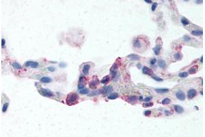 Human Lung, Neutrophils (formalin-fixed, paraffin-embedded) stained with EMR2 antibody ABIN213507 at 2-24 ug/ml followed by biotinylated goat anti-rabbit IgG secondary antibody ABIN481713, alkaline phosphatase-streptavidin and chromogen. (EMR2 antibody  (N-Term))
