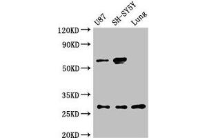 Western Blot Positive WB detected in: U87 whole cell lysate, SH-SY5Y whole cell lysate, Rat lung tissue All lanes: NEUROG2 antibody at 3 μg/mL Secondary Goat polyclonal to rabbit IgG at 1/50000 dilution Predicted band size: 29 kDa Observed band size: 29, 60 kDa (Neurogenin 2 antibody  (AA 194-262))