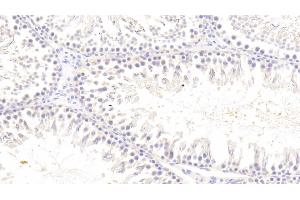 Detection of TREM2 in Rat Testis Tissue using Polyclonal Antibody to Triggering Receptor Expressed On Myeloid Cells 2 (TREM2) (TREM2 antibody  (AA 1-228))