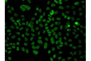 Immunofluorescence analysis of A549 cells using PLCXD2 antibody. (PLCXD2 antibody)