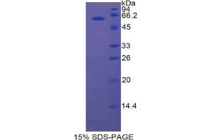 SDS-PAGE analysis of Rat Lipase, Hepatic Protein. (LIPC Protein)