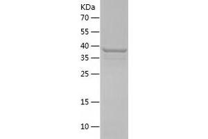 Western Blotting (WB) image for Syndecan 1 (SDC1) (AA 18-254) protein (His tag) (ABIN7125280) (Syndecan 1 Protein (SDC1) (AA 18-254) (His tag))