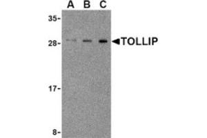 Image no. 1 for anti-Toll Interacting Protein (TOLLIP) (Middle Region) antibody (ABIN265154) (TOLLIP antibody  (Middle Region))