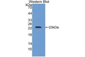 Western Blotting (WB) image for anti-Superoxide Dismutase 2, Mitochondrial (SOD2) (AA 25-222) antibody (ABIN1078543)