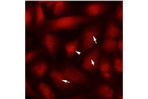 Immunofluorescence (IF) image for anti-Tubulin, beta 2B (TUBB2B) antibody (ABIN567612) (TUBB2B antibody)