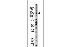 Antibody is used in Western blot to detect UBE4B in mouse kidney tissue lysate. (UBE4B antibody  (N-Term))