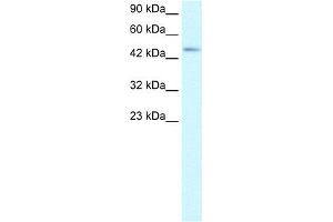 WB Suggested Anti-CCR8 Antibody Titration:  2. (CCR8 antibody  (Middle Region))