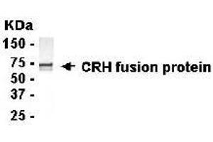 Image no. 1 for anti-Corticotropin Releasing Hormone (CRH) (AA 27-196) antibody (ABIN294738) (CRH antibody  (AA 27-196))