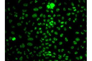 Immunofluorescence analysis of HeLa cells using MKI67 antibody (ABIN4904374).