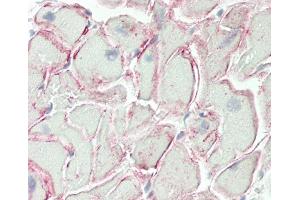 Formalin-fixed and paraffin-embedded H. (TMIGD2 antibody  (AA 119-147))
